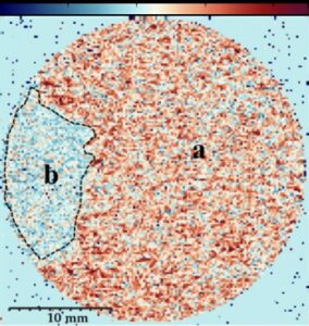 Image du développement d'un biofilm (zone b) dans un milieu poreux obtenue par IRM